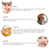 Peeling Acne Treatment